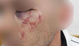 以色列警察在一名巴勒斯坦囚犯的脸上烙上大卫之星