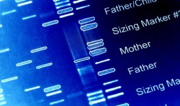 研究人员表示，遗传咨询、BRCA检测可以降低黑人女性的癌症发病率