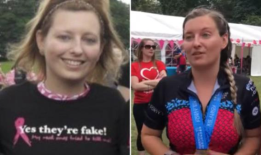 就在我切除乳房后留下的疤痕上方的一个小点颠覆了我的世界