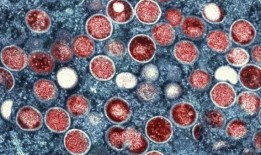 非洲麻疹暴发：卫生部说，新加坡面临的直接风险很低